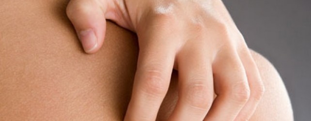 Reasons Why Scars Itch