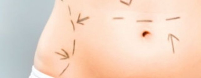 How to Minimize Plastic Surgery Scars