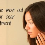 Getting the Most Out of Your Scar Treatment