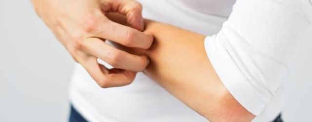 What is Excoriation Skin Picking Disorder?