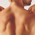 Back Acne Scars - Treatment Options via @inviciblescars #acne