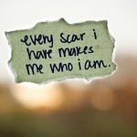 How to Get Rid of Purple Scars